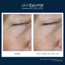 WFP-400304-W23-SKB-BA-2000x2000_0012_Instant Effect Gel EYE EN