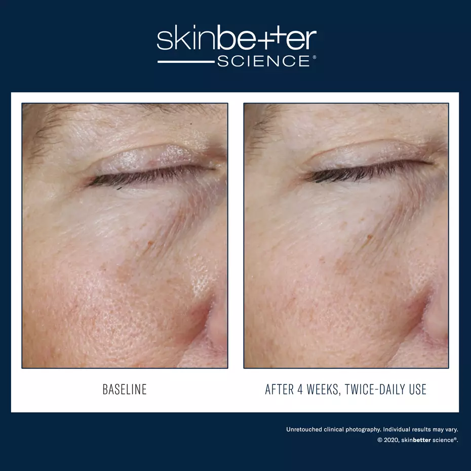 WFP-400304-W23-SKB-BA-2000x2000_0012_Instant Effect Gel EYE EN