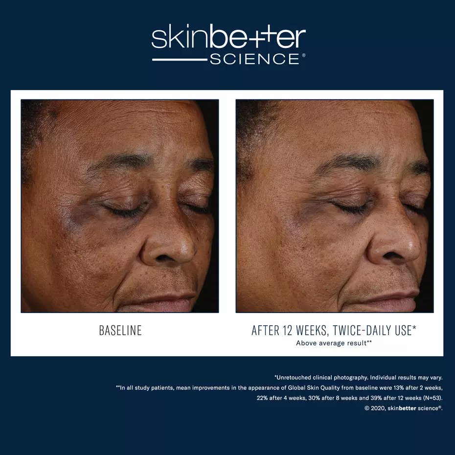 WFP-400304-W23-SKB-BA-2000x2000_0018_Mystro Active Balance Serum EN